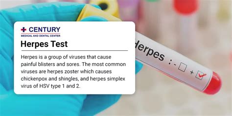 However, even in the newer <b>tests</b>, <b>false</b> positives can occur around 5 percent of the time. . How common is a false positive herpes test